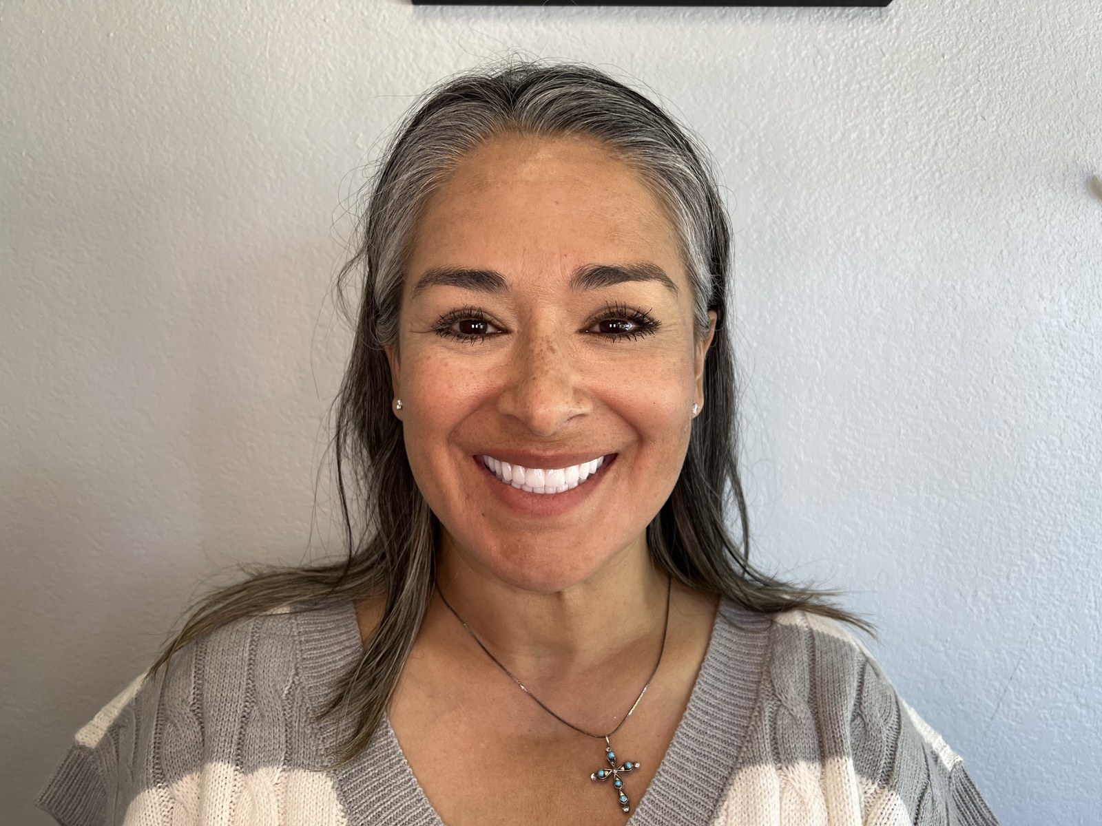 Patient smiling with her new veneers